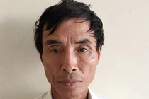 Đánh cụ ông 83 tuổi gãy 2 tay vì tiếng.... chó sủa 