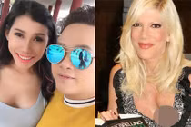 Đâu chỉ Ivy Trần, nhiều sao Hollywood cũng biến chứng hậu nâng ngực