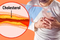 7 dấu hiệu tắc động mạch cực nguy hiểm thường bị bỏ qua