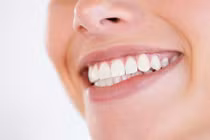 Bí quyết đơn giản để có hàm răng trắng xinh đón Tết