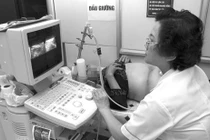 Xương mũi thai ngắn có nguy cơ bị down?