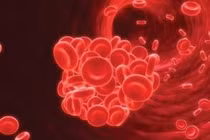 Bệnh ung thư gây đông máu?