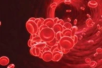 Bệnh ung thư gây đông máu?