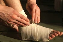 Tại sao bong gân phải bó bột?