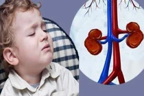 Bệnh thận ở trẻ em do di truyền?