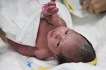 Những ca đẻ rơi kỳ lạ nhất Việt Nam