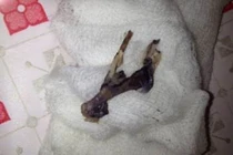 Hóc xương gà vì vừa ăn vừa nói