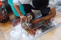 Mọc u giun do uống rượu huyết