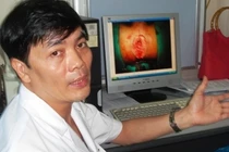 Hoại tử hậu môn vì đắp thuốc khi bị trĩ