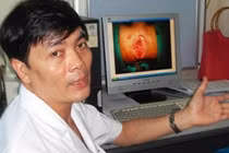 Hoại tử hậu môn vì đắp thuốc khi bị trĩ