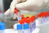 Giải mã gen người Việt để cải tạo giống nòi