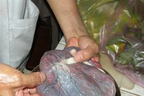 Ký sinh trùng, mầm bệnh từ “thần dược” 