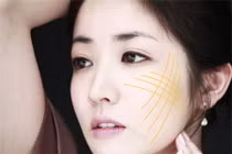 400 triệu cho 30 phút căng da mặt bằng chỉ vàng