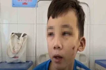 Chủ quán bánh xèo tra tấn nhân viên: Toàn phải ăn đồ thừa của khách