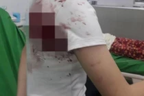 Mâu thuẫn trong trường, một nữ sinh ở Đồng Nai bị đâm trọng thương