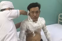 Nhân chứng kể phút tháo chạy bất thành của nghi phạm xông vào cướp ngân hàng