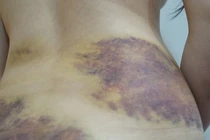 Vụ nghi bạo hành, ép quan hệ tình dục ở Tây Ninh: Nạn nhân yêu cầu xử lý hình sự