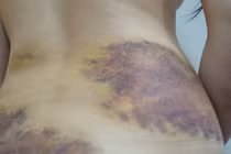 Vụ nghi bạo hành, ép quan hệ tình dục ở Tây Ninh: Nạn nhân yêu cầu xử lý hình sự