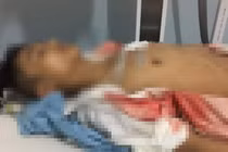 Nam sinh lớp 11 bị bạn đâm vào ngực ở cổng trường