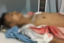 Nam sinh lớp 11 bị bạn đâm vào ngực ở cổng trường