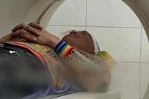 Giang hồ mạng Huấn “hoa hồng” nghi bị đánh phải nhập viện