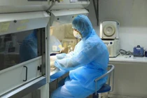 Từ vụ CDC Hà Nội "ăn tiền bẩn": Tù mù giá thiết bị y tế