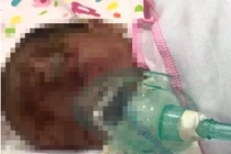 Bé trai 3 ngày tuổi bị bỏ rơi ở ven đường, trên mặt có nhiều vết xước