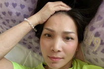 Nhan sắc ca sĩ Hồng Ngọc thế nào sau 2 tháng bị bỏng?