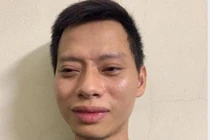 Vì câu nói trêu đùa, đối tượng đấm bạn nhậu tử vong