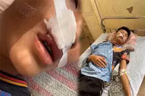 Nam sinh bị bạn học cùng trường đánh nhập viện ở Hà Nội