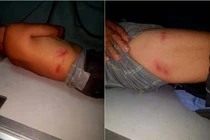 Cô gái cầm gậy đánh cụ ông ở Quảng Nam: Quan hệ thế nào?