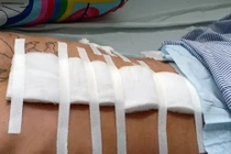 Giang hồ Hùng “sứt” nổ súng, 4 người bị thương: Nguyên do từ đâu?