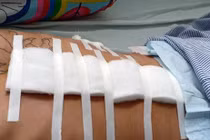 Giang hồ Hùng “sứt” nổ súng, 4 người bị thương: Nguyên do từ đâu?