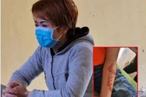 Chủ quán bánh xèo tra tấn nhân viên: Quặn lòng những vụ bạo hành trẻ em