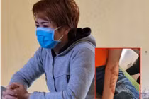 Chủ quán bánh xèo tra tấn nhân viên: Quặn lòng những vụ bạo hành trẻ em