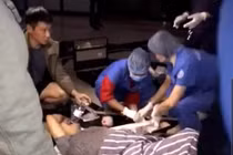 Người đàn ông ngã xuống sảnh khi bước ra từ thang máy chung cư Golden Land