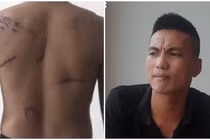 Khởi tố vụ côn đồ chém người, Đường “Nhuệ” dàn xếp cách đây 8 năm