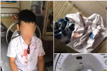 Phụ huynh xông vào trường, hành hung học sinh lớp 1