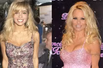 10 ngôi sao nổi tiếng hơn nhờ phẫu thuật thẩm mỹ