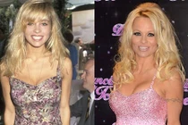 10 ngôi sao nổi tiếng hơn nhờ phẫu thuật thẩm mỹ