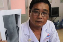 Cổ bị nổi lục cục chi chít vì tiêm chất làm trắng da