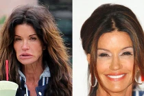 Mặt mộc khủng khiếp của sao Hollywood