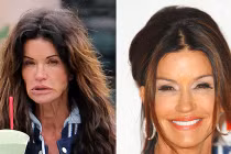 Mặt mộc khủng khiếp của sao Hollywood