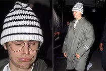 Justin Bieber xuống mã trầm trọng khiến fan sốc