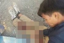 Quay clip cãi nhau, nam thanh niên bị chém trọng thương