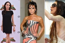 Loạt sao Hollywood gầy gò thảm hại gây sốc không kém Cao Ngân