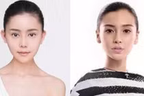 Cô gái “lột xác” sau phẫu thuật thẩm mỹ để giống Angelababy