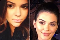 Bị nghi phẫu thuật thẩm mỹ, Kendall Jenner phản ứng thế nào?