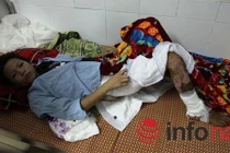 Mẹ nóng giận “lỡ tay” xô con vào đống lửa