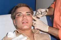 Cận cảnh 3 tiếng tiêm botox của búp bê sống Ken Doll